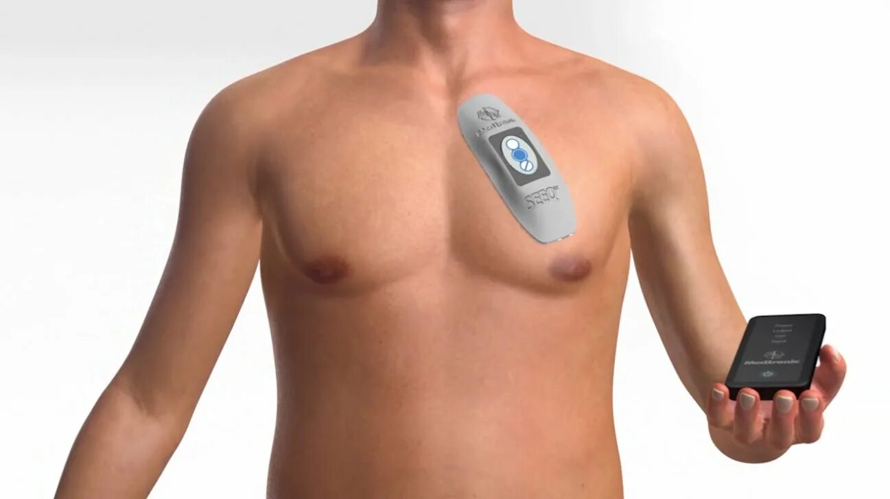 Мониторинг сердца. Холтер мониторирование экг. Холтеровский монитор экг крн-01. Суточное мониторирование экг (холтер). Холтер кардиотехника 07.