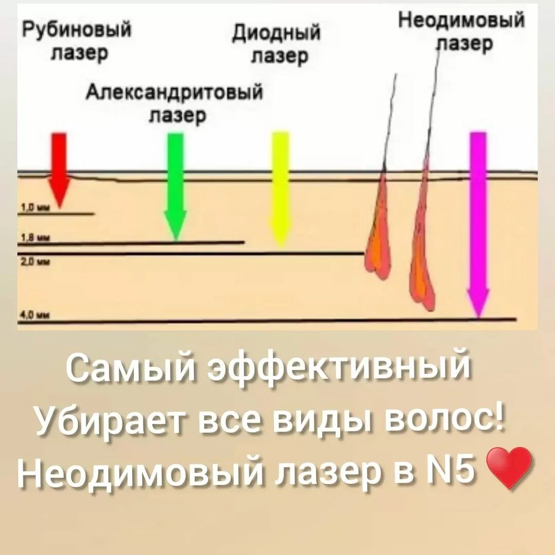 Тип лазерного излучения. Типы лазеров для эпиляции. длина волны лазерной эпиляции. длина волны для лазерной эпиляции волос.