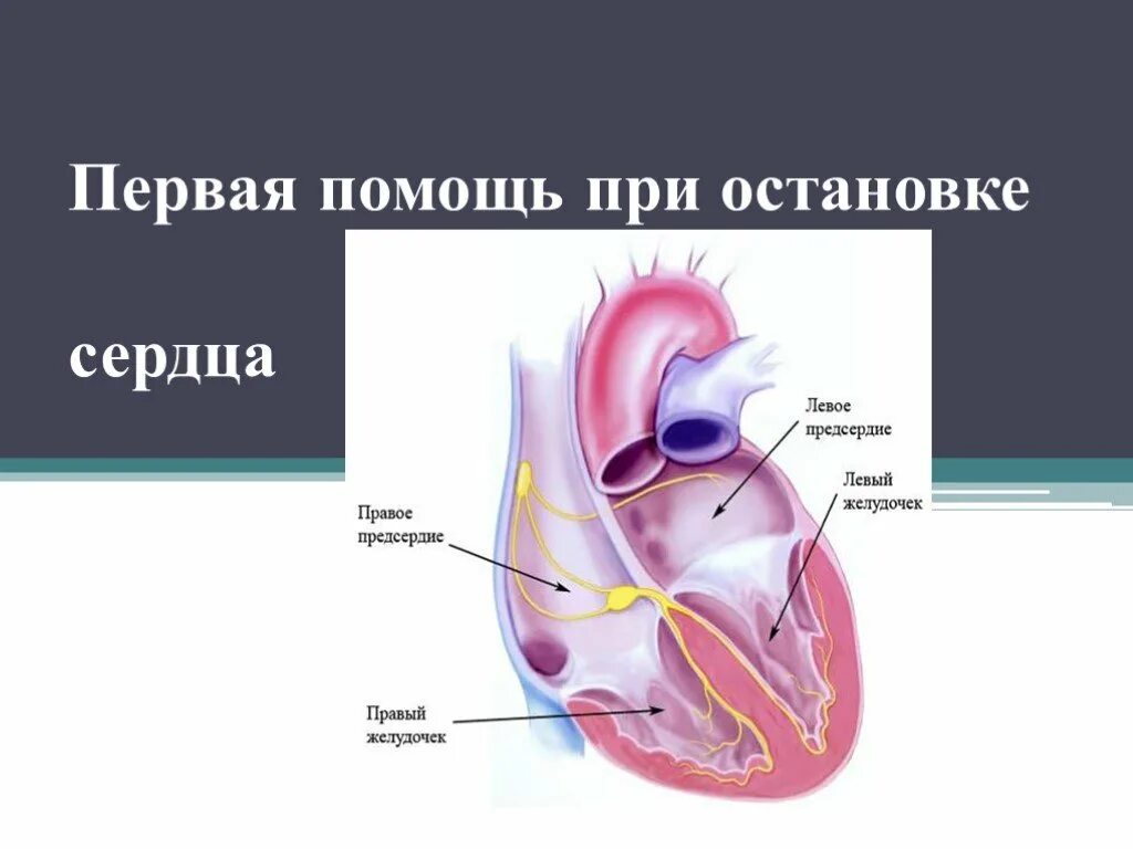 Первая помощь при остановке сердца. Первая помощь при остановке сержце. Первая помощь пр остановке сердце. Памятка первая помощь при остановке сердца. Алгоритмы помощи при остановке сердца