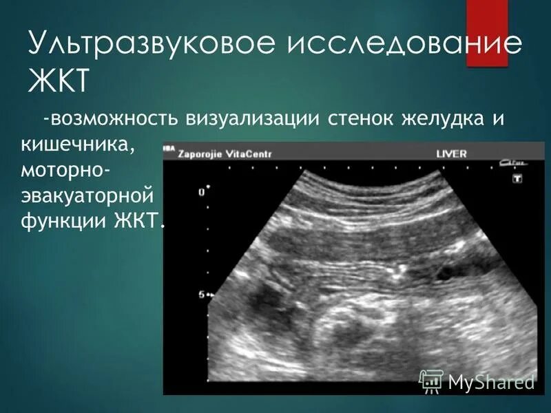 подготовка к узи органов малого таза алгоритм. узи желудочно кишечного тракта подготовка. узи брюшной полости. узи желудочно кишечного тракта подготовка. узи органов брюшной полости подготовка.