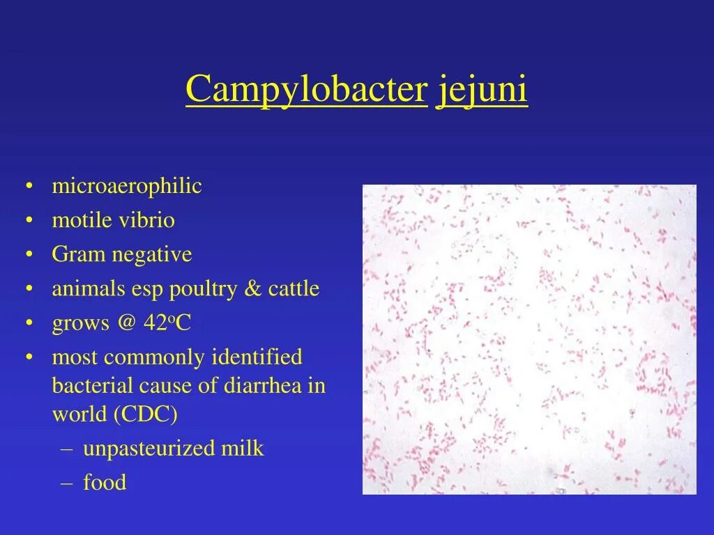Кампилобактер. Кампилобактер. Campylobacter fetus возбудитель. Бактерия campylobacter. Кампилобактер микроскопия.