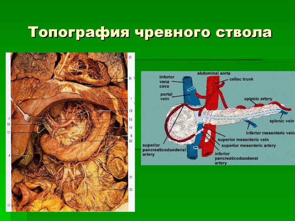 Чревный ствол анатомия препарат. Чревный ствол брюшной аорты анатомия. Чревный ствол анатомия топография. Кровоснабжение чревного ствола. Артерии органов брюшной полости