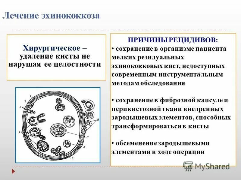 эхинококкоз схема лечения. эхинококк диагностика. основные методы эхинококкоза. как лечить эхинококк. эхинококкоз лекарства.