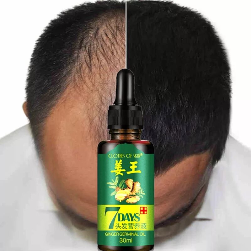 Масло для волос для мужчин. Hair Oil 30 ml growth. Китайские средства для волос. Китайское средство для роста волос. Масло от облысения для мужчин.