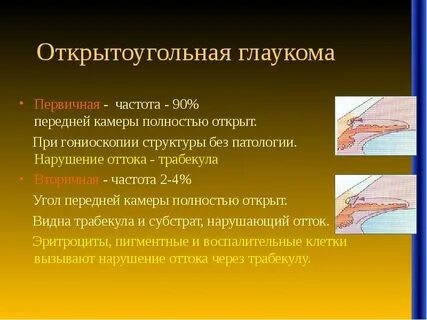 Первая стадия глаукомы