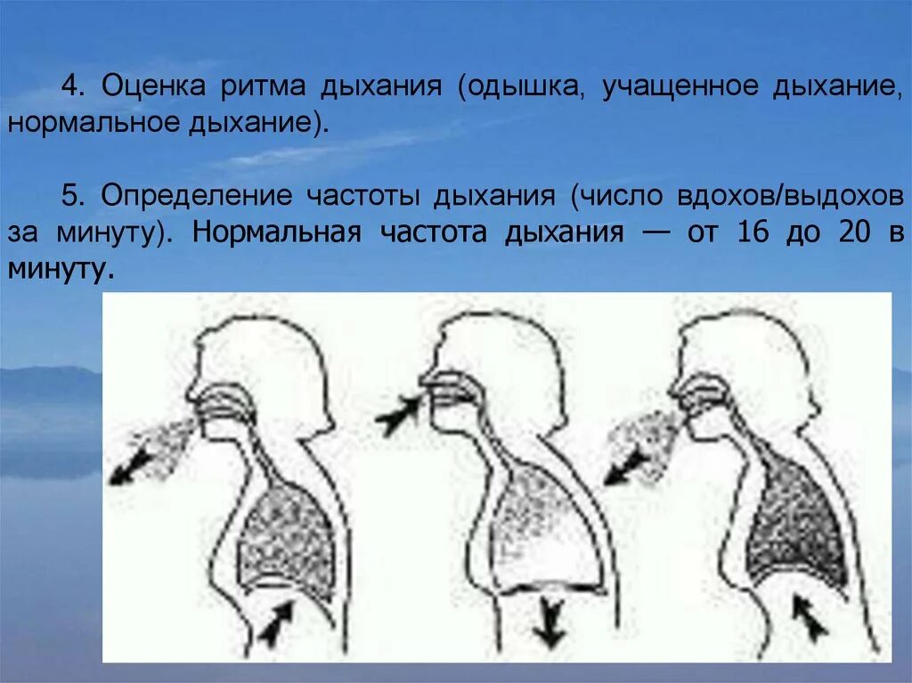 Дыхание 5 групп. Оценка ритма дыхания. Оценка дыхания схема. Оценка частоты дыхания. Одышка частота дыхания.