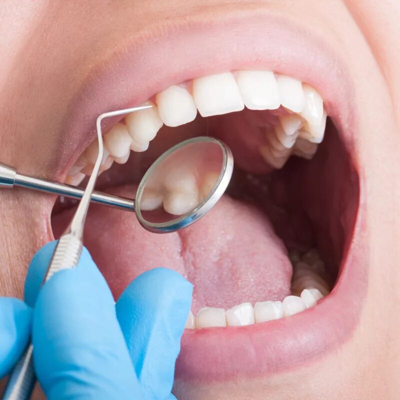 Зубной свободный. Терапевтическая стоматология. Зубы стоматолог. Терапия стоматология.