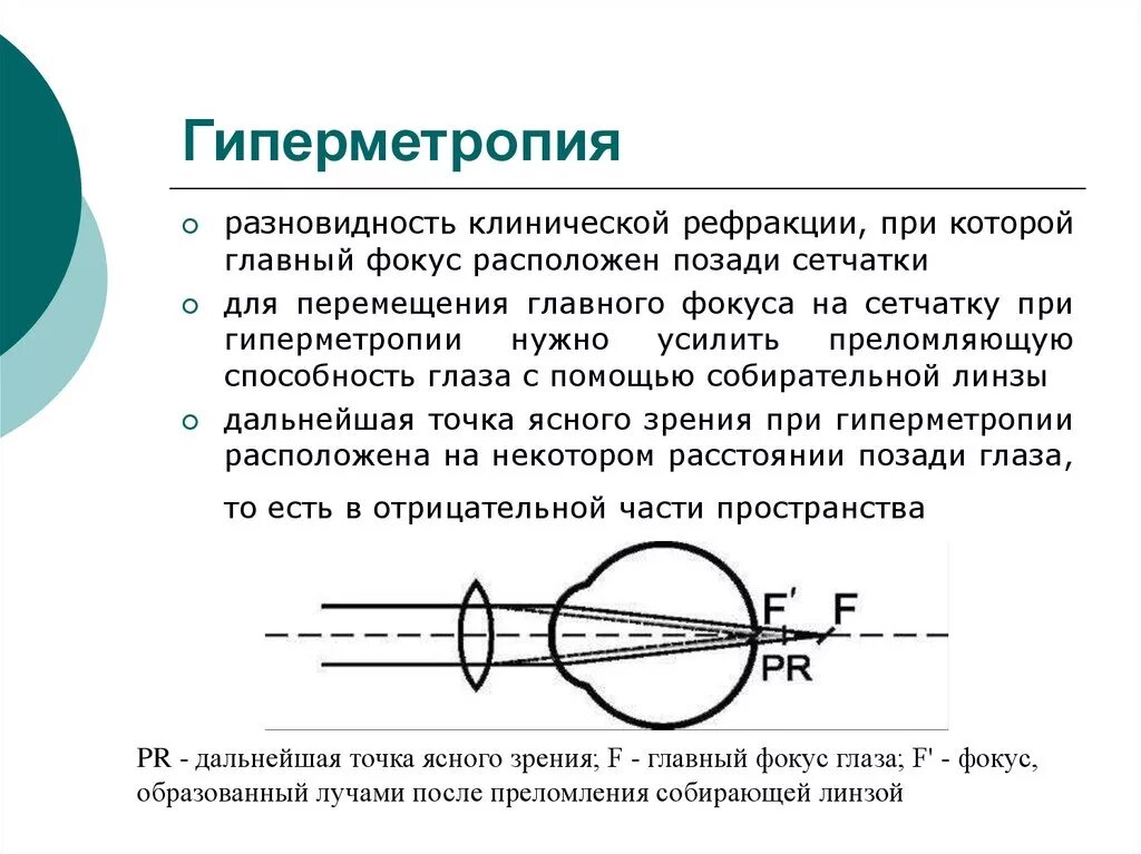 Точка лежащая зрение. Гиперметропия клинические проявления и коррекция. Клинические проявления гиперметропии. Главный фокус при гиперметропии расположен. Гиперметропия высокой степени острота зрения.