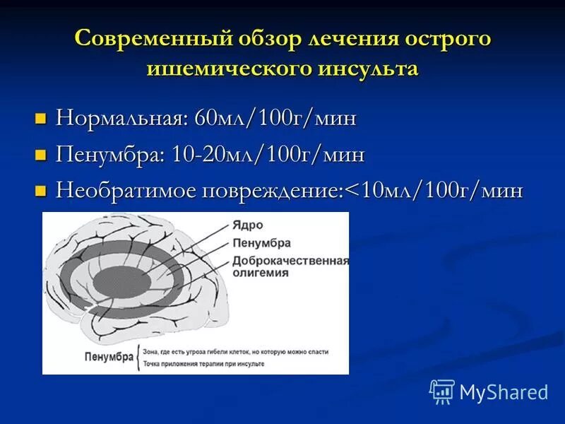 Ишемическая полутень Пенумбра. Пенумбра зона ишемической полутени. Ишемический инсульт Пенумбра.