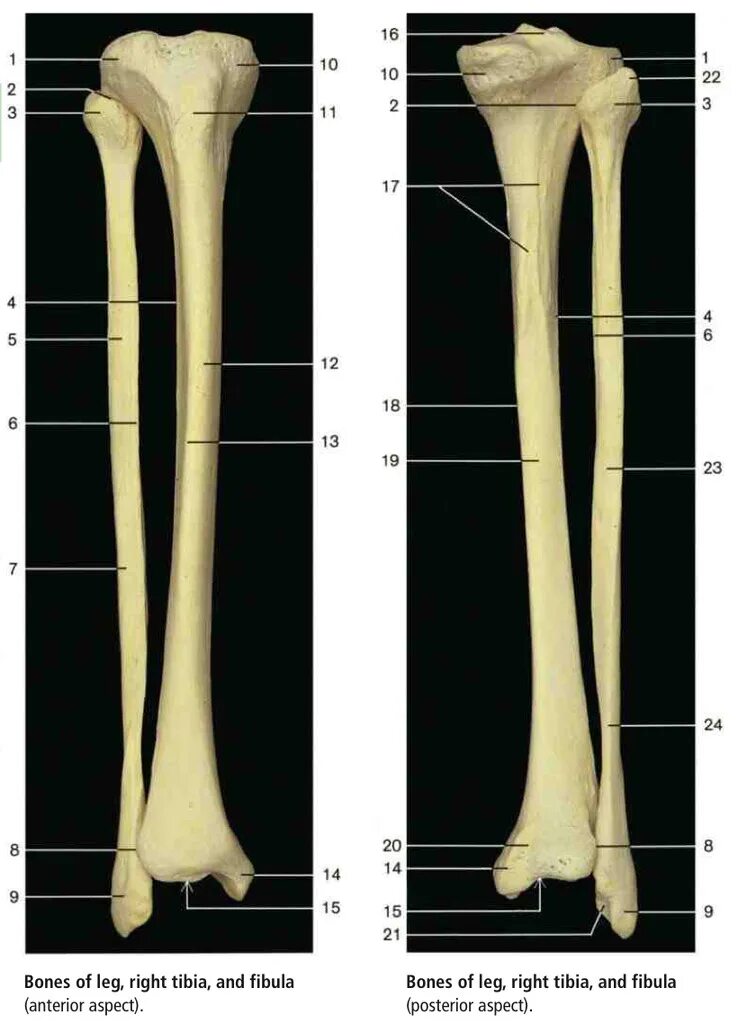 Curved tibia fibula. Curved tibia fibula