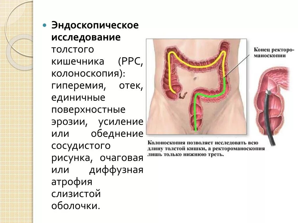 Исследование прямой и сигмовидной кишки. Эндоскопическое исследование Толстого кишечника кишки. Название эндоскопическое исследование Толстого кишечника. Эндоскопическое исследование высоких отделов толстой кишки. Колоноскопия ободочной кишки.