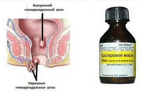 Чем лечить задний проход у женщин