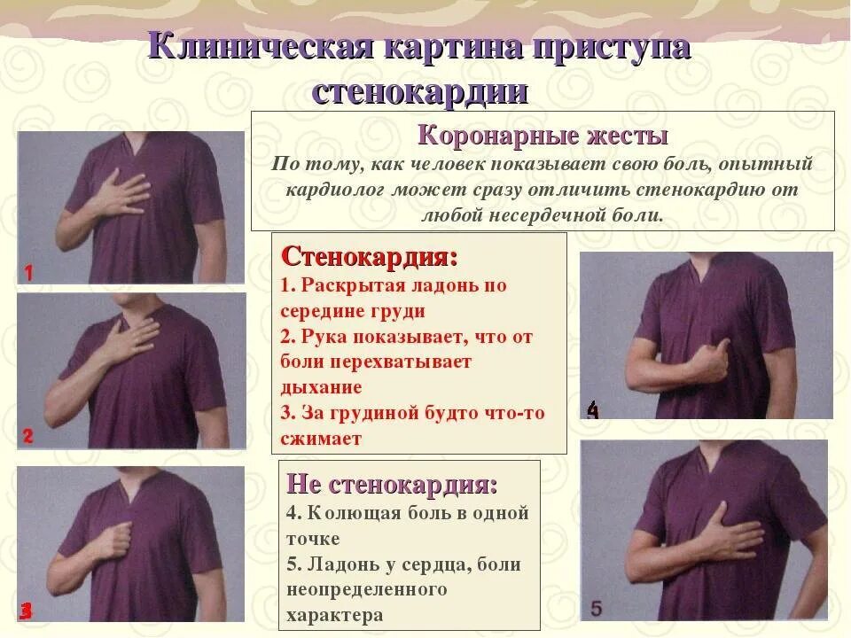 Положение при стенокардии