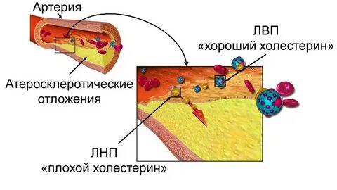 Плохой холестерин это