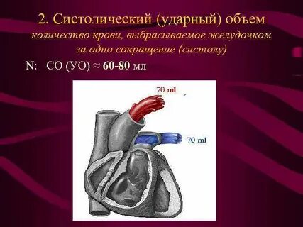 Систолический объем