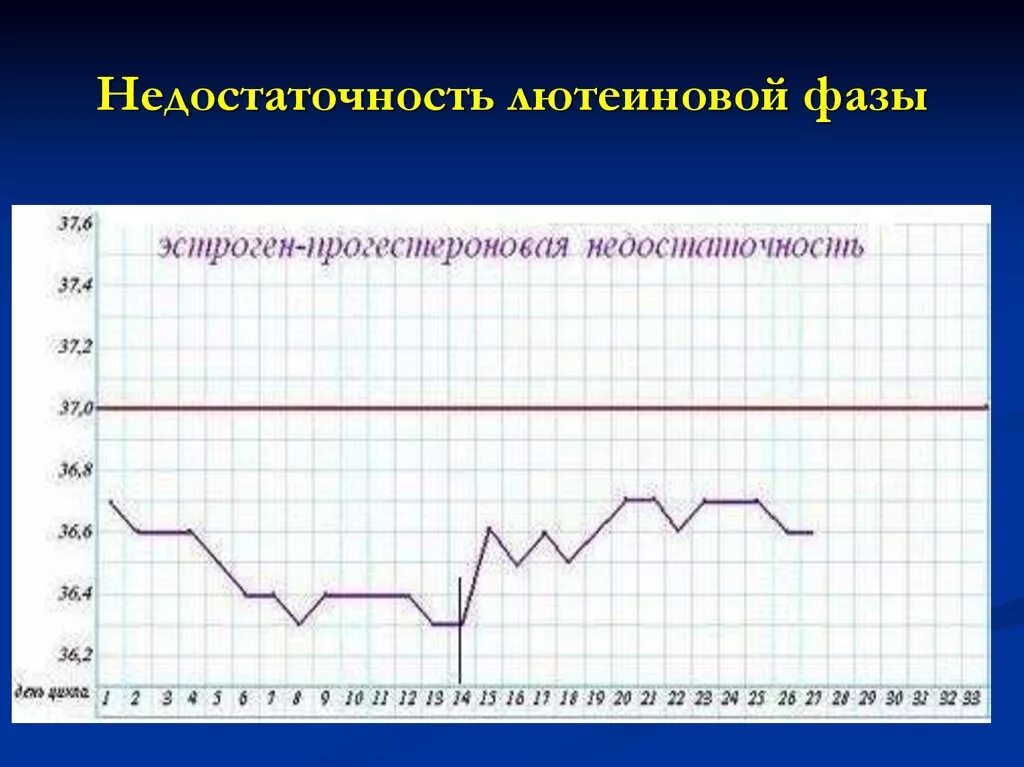 Лютеиновая фаза симптомы. Недостаточность лютеиновой фазы. Базальная температура при недостаточности лютеиновой фазы. НЛФ недостаточность лютеиновой. Недостаточность II фазы менструального цикла.