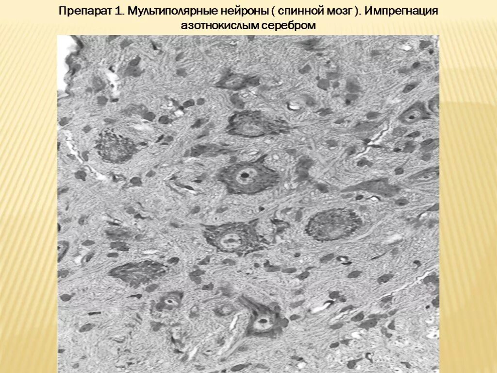 Спинной мозг гистология импрегнация серебром. Мультиполярный Нейрон импрегнация серебром. Мультиполярные Нейроны спинного мозга гистология препарат. Мультиполярный Нейрон спинной мозг импрегнация серебром.