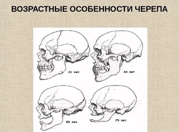 Возрастные особенности формирования черепа. Возрастные особенности черепа анатомия. Возрастные изменения черепа анатомия. Возрастные особенгости череп.