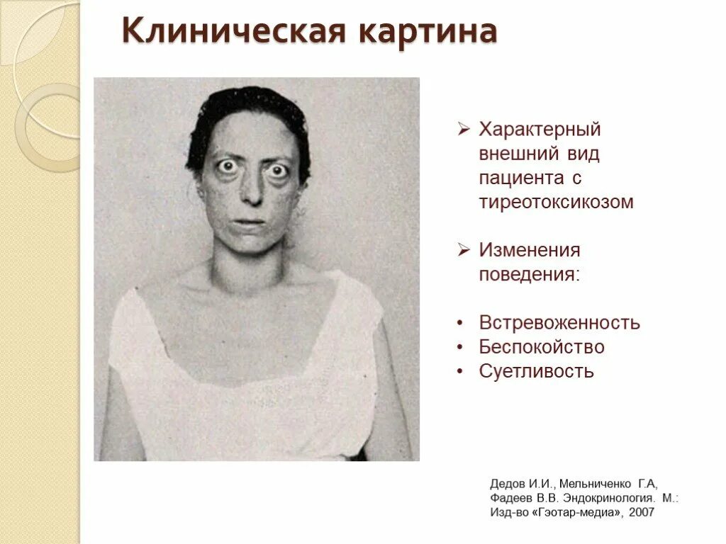 Типичные изменения