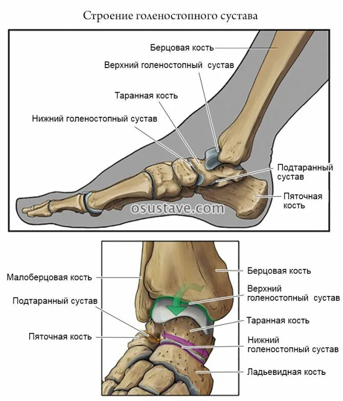 где другая нога