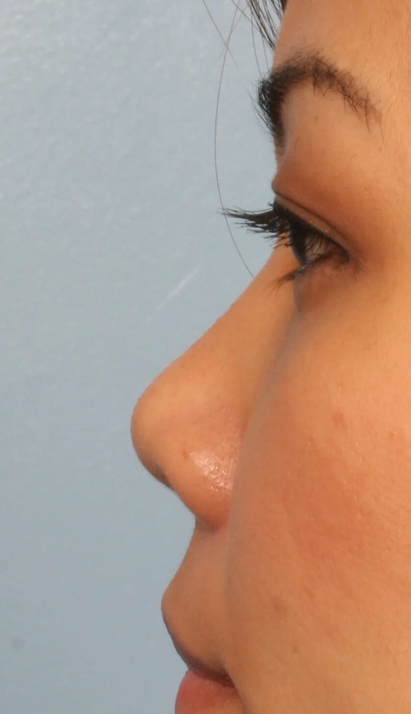 нажать на нос