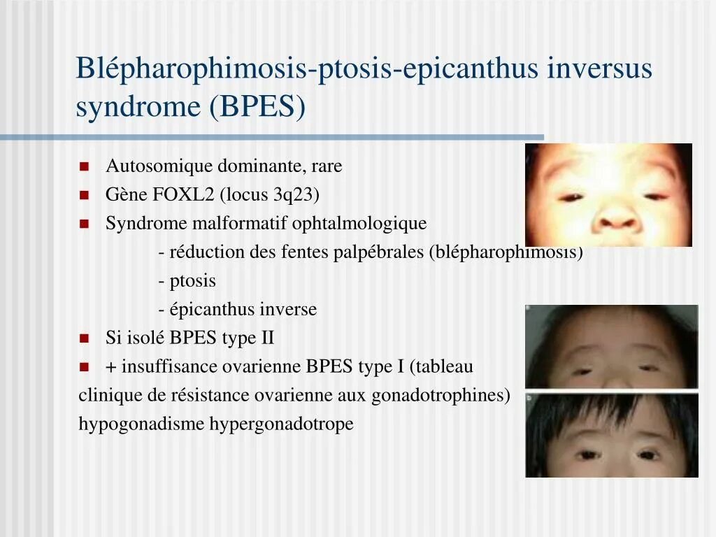 Ptosis латынь