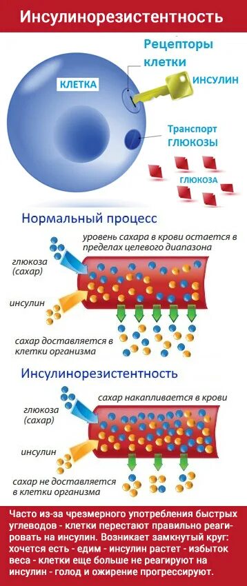 Инсулинорезистентность симптомы у мужчин. Инсулинорезистентность. Инсулинорезистентность клетки. Как развивается инсулинорезистентность. Инсулин и инсулинорезистентность.