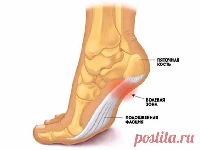 Почему болит пятка у ребенка
