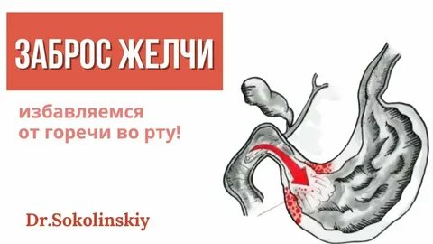Заброс желчи в желудок что делать