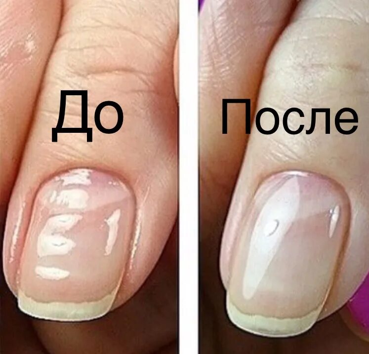 выравнивание ногтевой пластины. выравнивание ногтей. как выровнять ногти на руках. маникюр с выравниваем базой. маникюр без выравнивания ногтевой пластины.