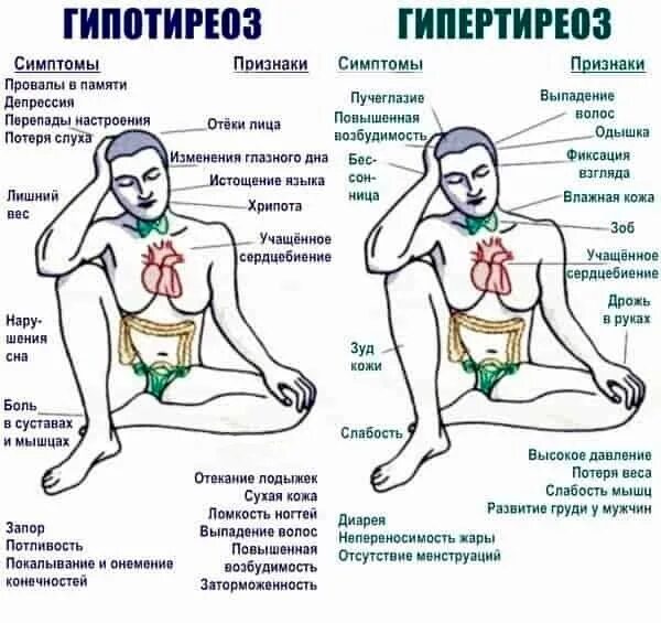 Гипертиреоз симптомы у мужчин. Гипертиреоз симптомы у мужчин признаки. Гипертиреоз щитовидной железы у мужчин.