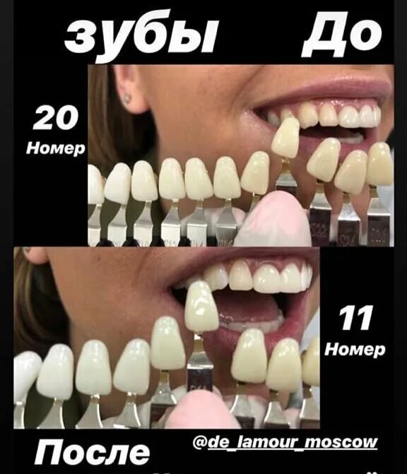 нумерация зубов в стоматологии. схема зубов человека с нумерацией стоматологии. нумерация зубов человека в стоматологии схема у взрослых. нумерация молочных зубов в стоматологии схема. нумерация зубов нижней челюсти человека.