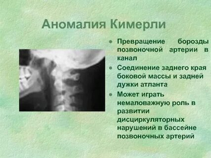 Аномалия развития кожи