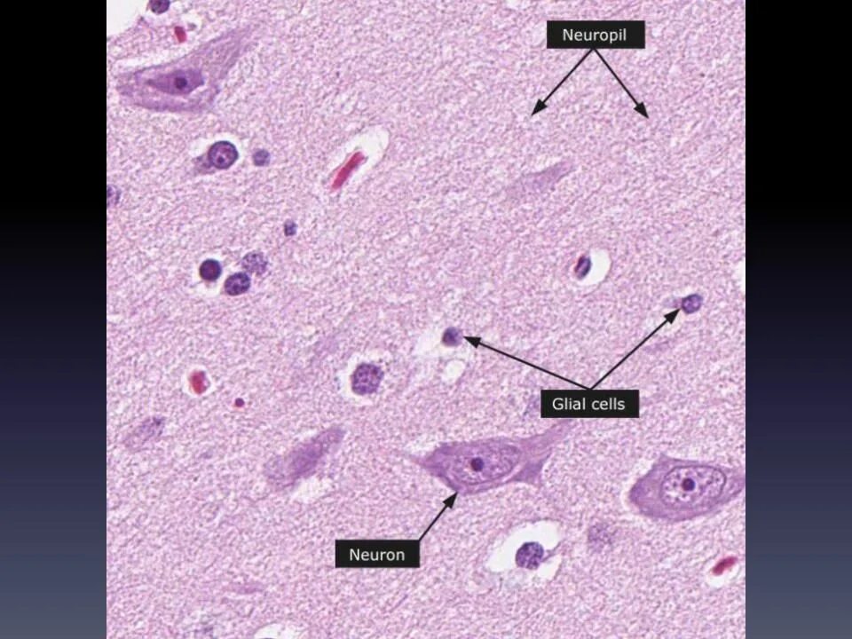 Микропрепарат головного мозга. Клетки нейроглии гистология. Макрофаги гистология. Хроматофильная субстанция гистология. Головной мозг микропрепарат гистология.