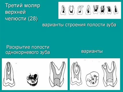 Корни моляров нижней челюсти