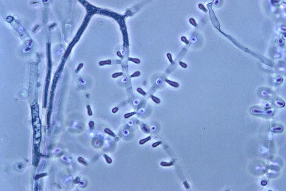 Trichophyton schoenleinii морфология. Гриб трихофитон. Trichophyton rubrum возбудитель трихофитии. Возбудитель. Микроскопия trichophyton verrucosum.