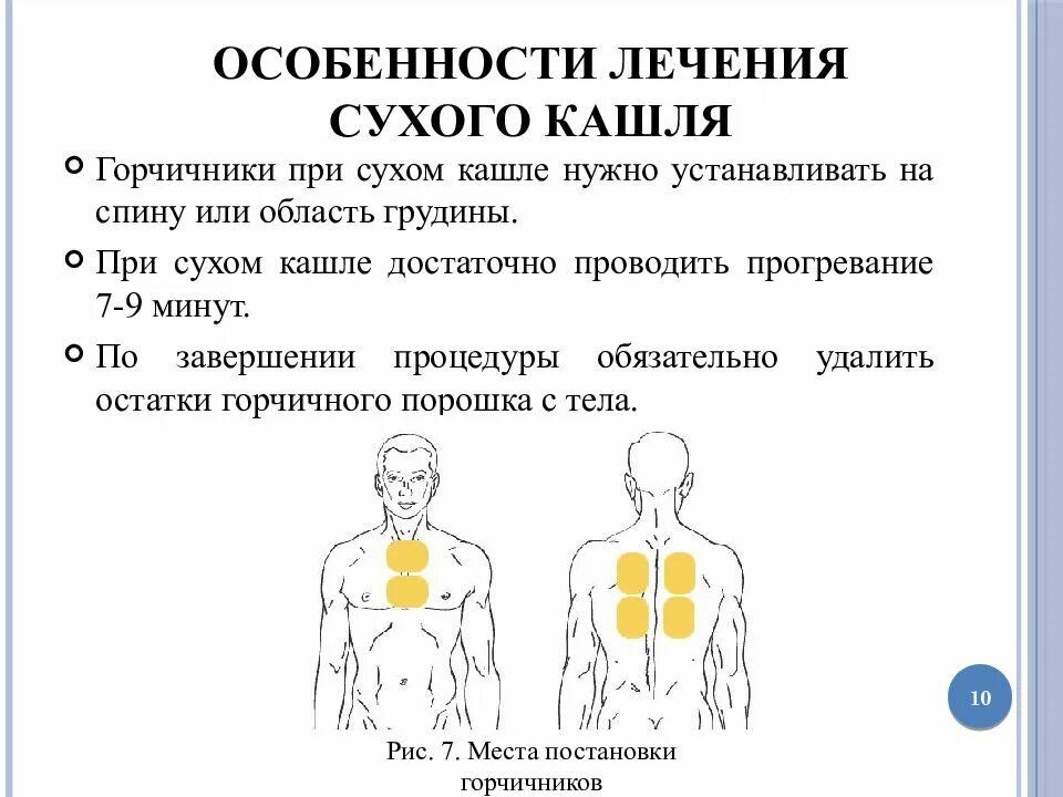 Сколько раз ставить горчичники. Схема горчичников при Сухом кашле. Схема постановки горчичников при кашле. Места постановки горчичников при кашле. Постановка горчичников при кашле.