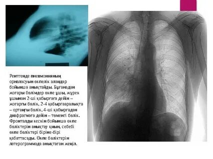 Павлово-на-Ока қаласындағы жезөкшелер