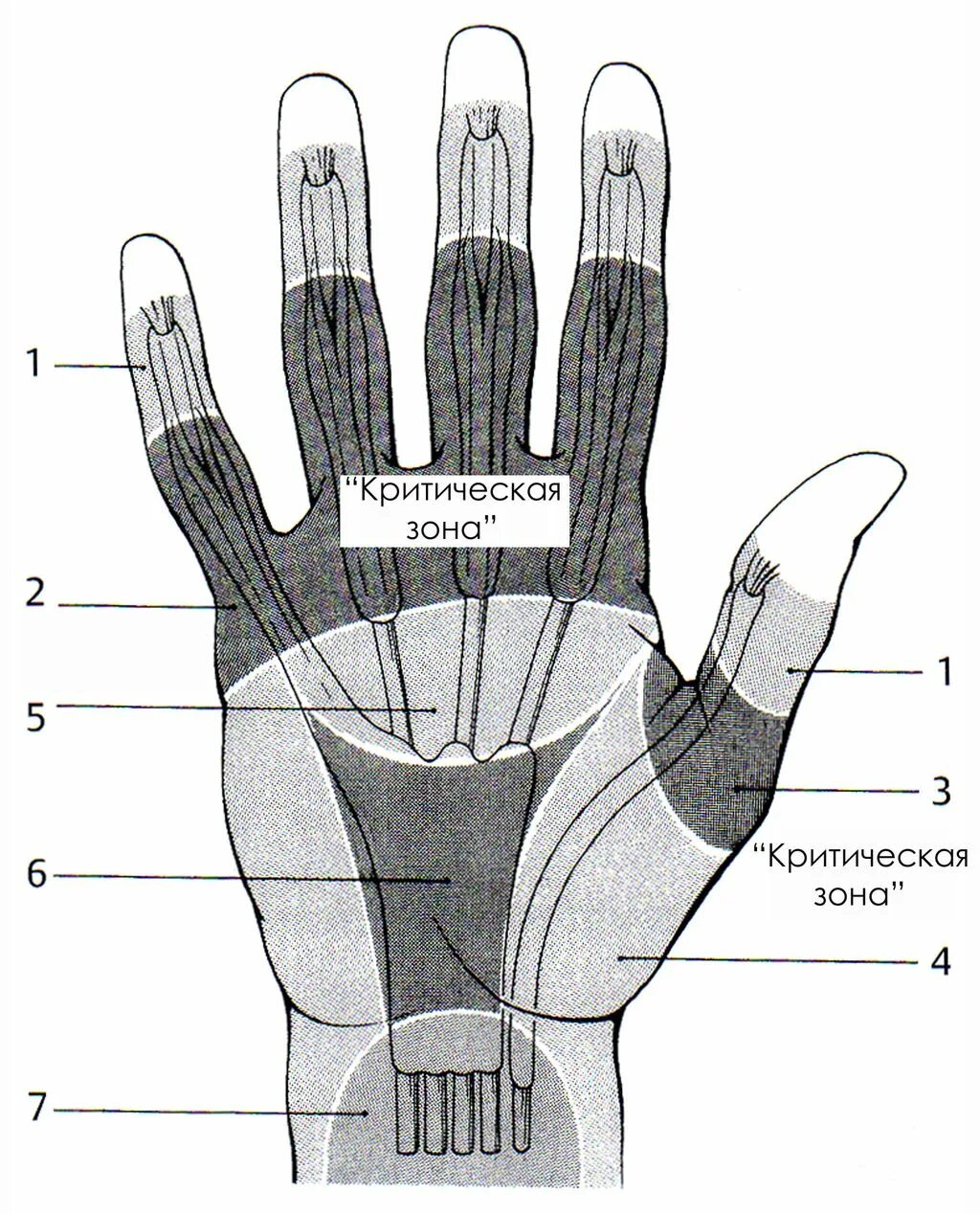 зоны повреждения сгибателей кисти. запретная зона коновалова. зоны кисти. запретная зона кисти по канавелу. запретная зона кисти.