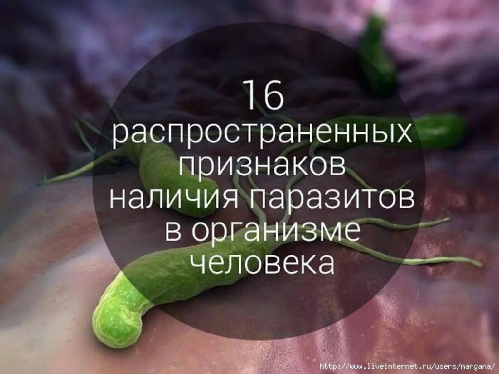 Симптомы паразитов у взрослого человека. Паразиты в организме человека. Признаки наличия паразитов в организме. Паразиты в организме человека симптомы. Признаки наличия глистов в организме.