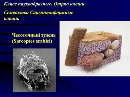 Сколько живет чесоточный