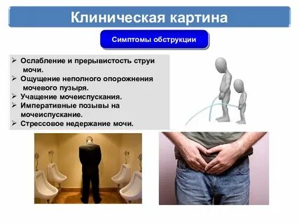 Неполное мочеиспускание