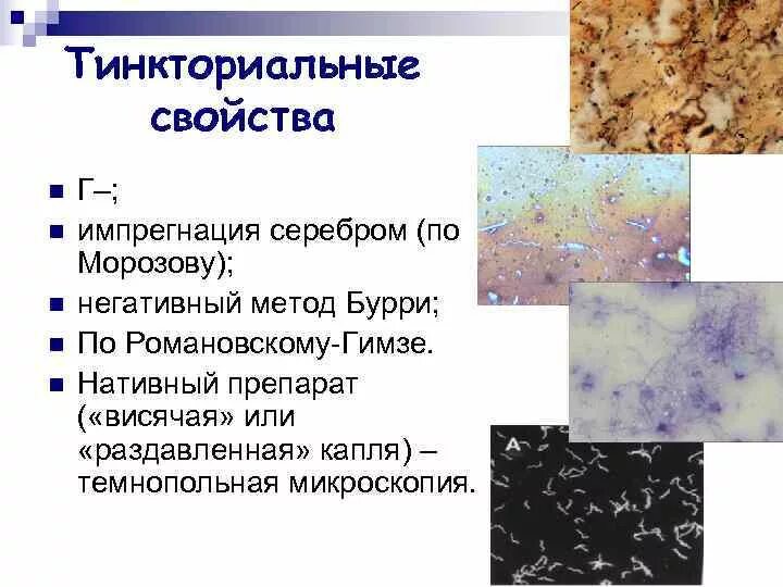 Тинкториальные свойства бактерий методы окраски. Морфологические и тинкториальные свойства бактерий. Тинкториальные свойства бактерий методы окраски. Тинкториальные свойства бактерий методы окраски. Морфологические свойства микроорганизмов.