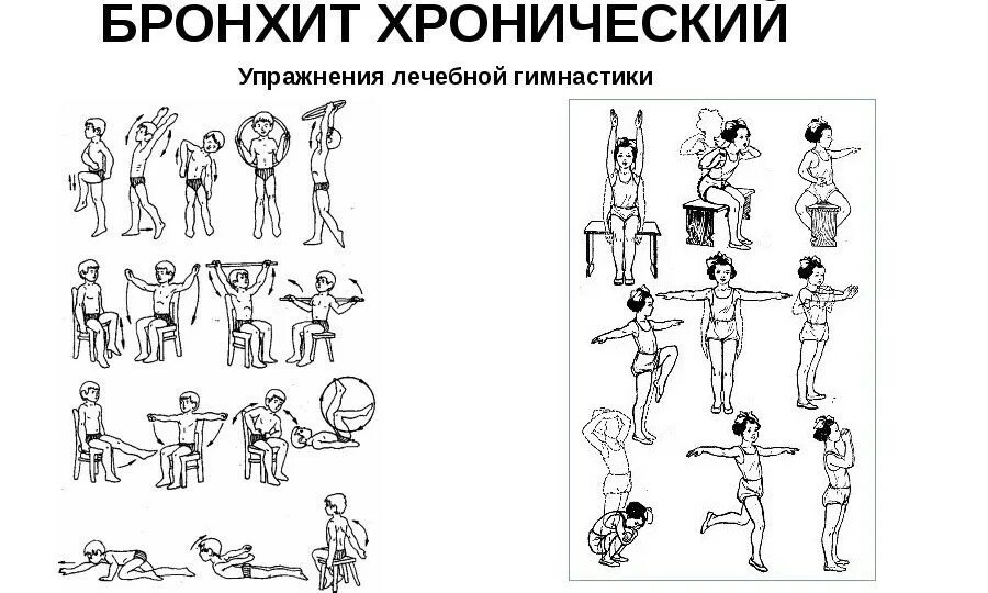 Гимнастика по стрельниковой при бронхите. Упражнения при бронхите. Упражнения для отхождения мокроты для детей. Упражнения после бронхита. ЛФК при бронхите.