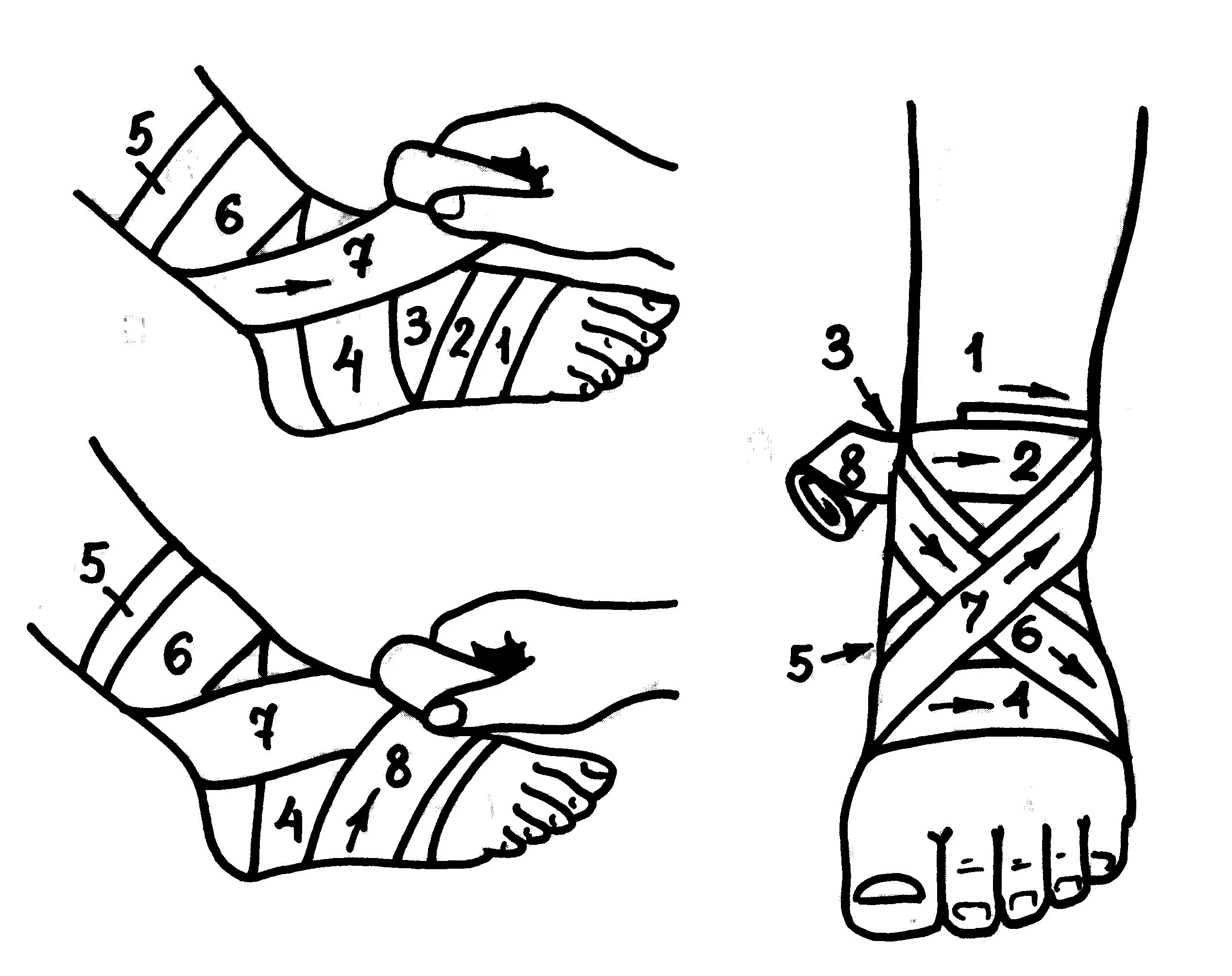 Восьмиобразная на голеностопный сустав. Повязка на голень десмургия. Схемы бинтования эластичного бинта. Перевязка запястья эластичным бинтом. Забинтовать голеностоп эластичным бинтом.