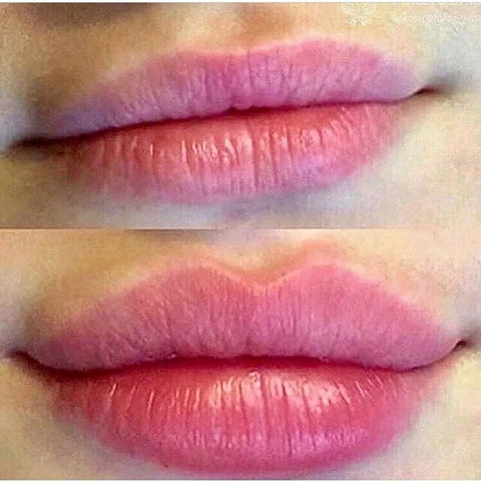 Форма губ бант. Техника увеличения губ бантиком. увеличение губ форма бантик.