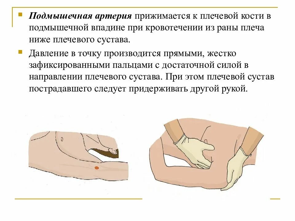 Пальцевого прижатия подмышечной артерии. Прижатие подмышечной артерии при кровотечении. Подмышечная артерия кровотечение. Подмышечная артерия прижимается при кровотечении.