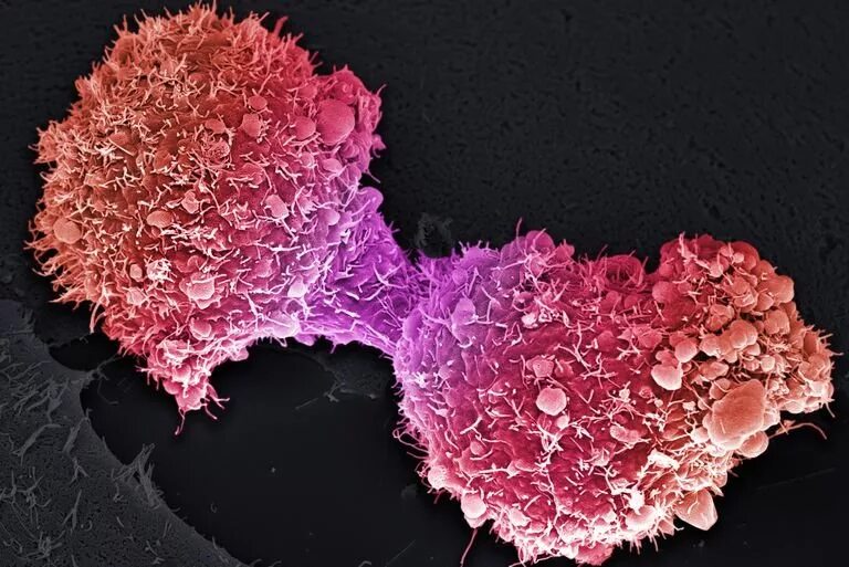 Наноонкология. Ингибирование раковых клеток. Распространение раковых клеток по организму. Питание раковой клетки