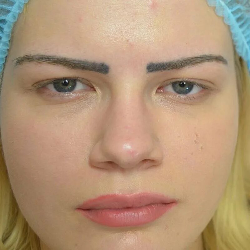 Испорченные брови татуажем. Неудачный та уаж бровей. Ужасный перманентный макияж бровей. Плохой татуаж бровей. Неудачный перманентный макияж.