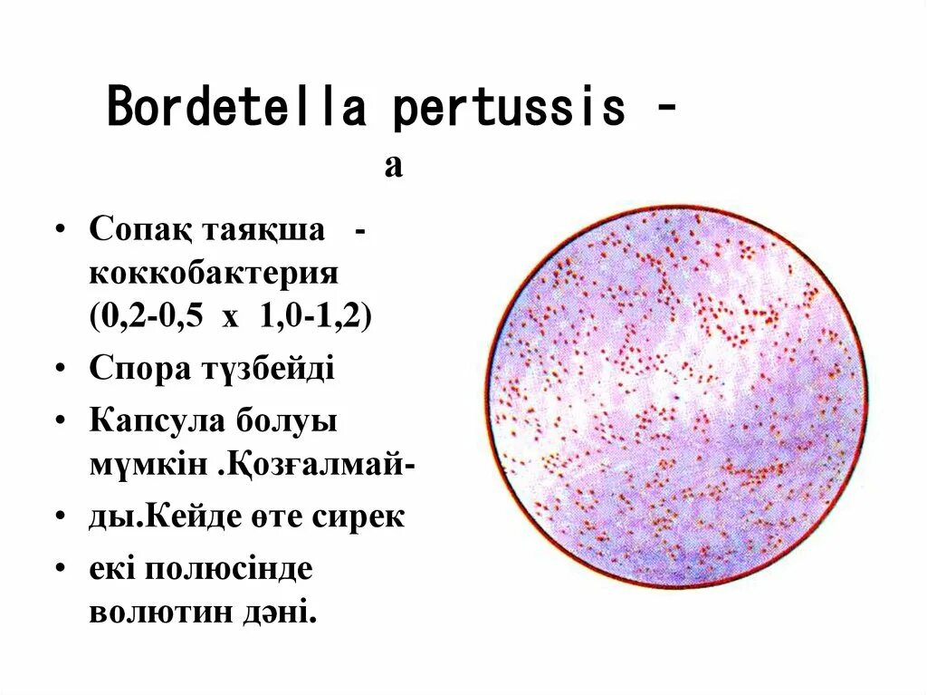 Pertussis коклюш. Bordetella pertussis антигенная структура. Бордетелла коклюшная. Bordetella пертуссис. Bordetella pertussis строение.